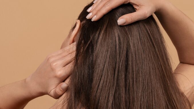 Best Treatments for Scalp Psoriasis – Ndius.com